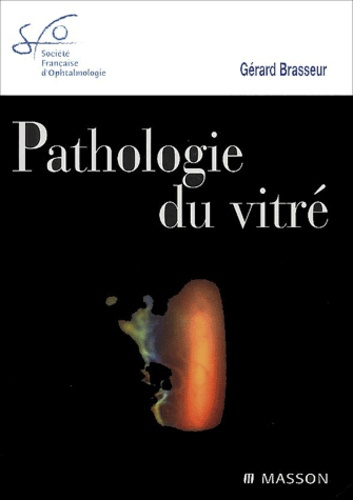 Emprunter Pathologie du vitré livre