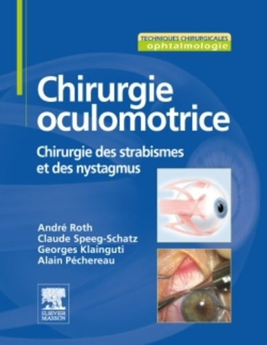 Emprunter CHIRURGIE OCULOMOTRICE - CHIRURGIE DU STRABISME ET DES NYSTAGMUS livre