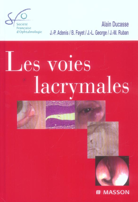 Emprunter Les voies lacrymales. Avec 1 DVD livre