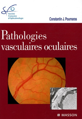 Emprunter Pathologies vasculaires oculaires livre