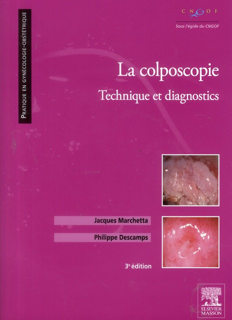 Emprunter La colposcopie / Technique et diagnostics livre