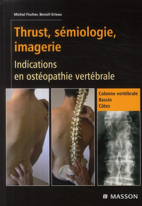 Emprunter Thrust, sémiologie, imagerie. Indications en ostéopathie vertébrale livre