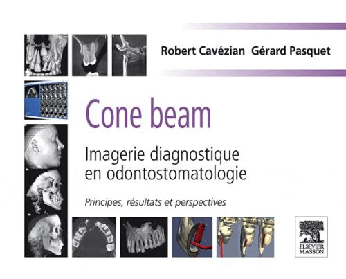 Emprunter CONE BEAM : IMAGERIE DIAGNOSTIQUE EN ODONTOSTOMATOLOGIE - PRINCIPES, RESULTATS ET PERSPECTIVES livre