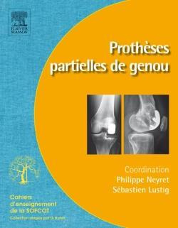 Emprunter Prothèses partielles du genou livre