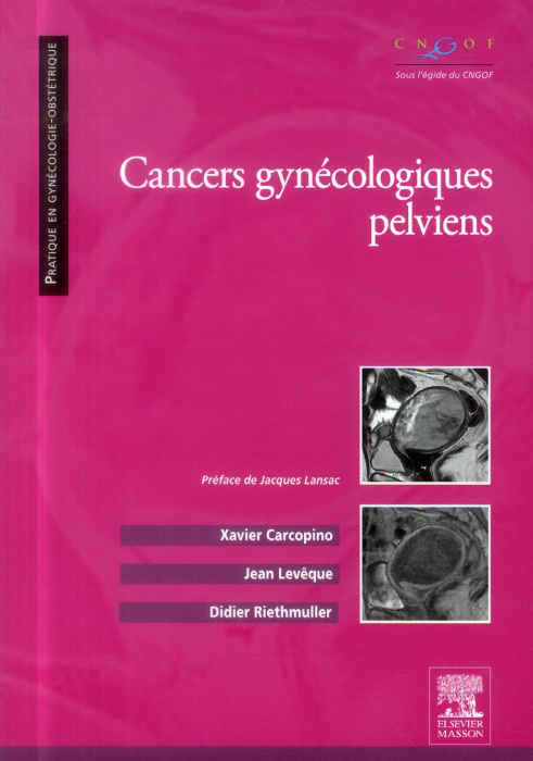 Emprunter Cancers gynécologiques pelviens livre