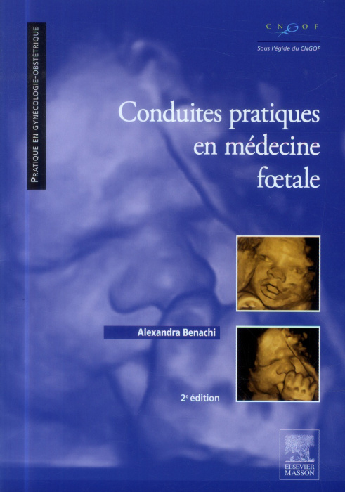 Emprunter Conduites pratiques en médecine foetale. 2e édition livre