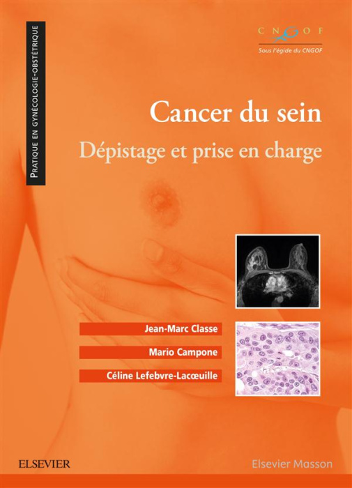 Emprunter Cancer du sein. Dépistage et prise en charge livre