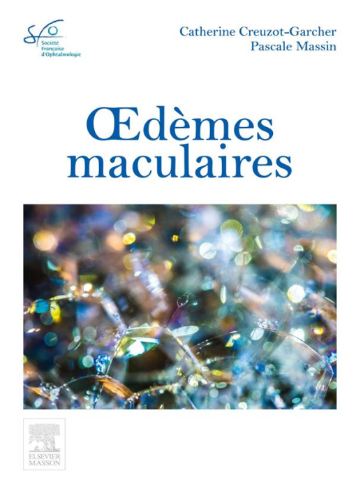 Emprunter Oedèmes maculaires livre