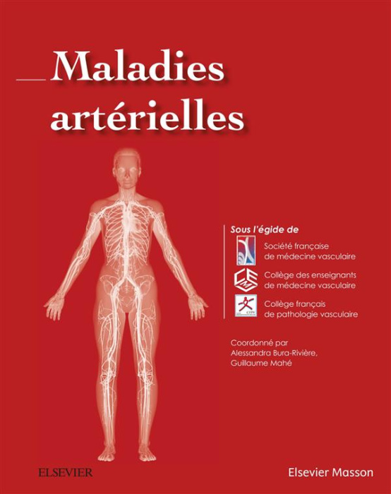 Emprunter Maladies artérielles livre