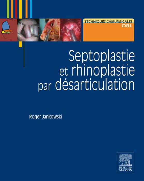 Emprunter Septoplastie et rhinoplastie par désarticulation. Histoire, anatomie, chirurgie et architecture natu livre