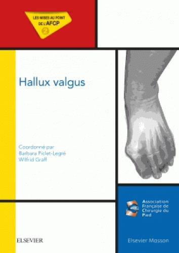Emprunter Hallux valgus livre