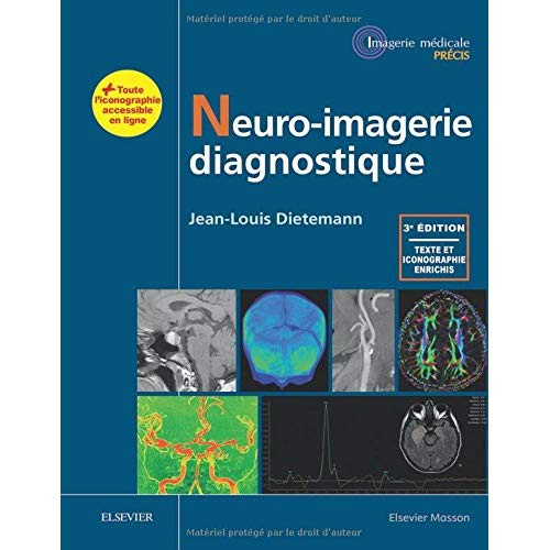 Emprunter Neuro-imagerie diagnostique. 3e édition livre