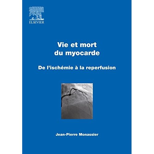 Emprunter Vie et mort du myocarde. De l'ischémie à la reperfusion livre