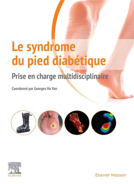Emprunter Le syndrome du pied diabétique. Prise en charge multidisciplinaire livre