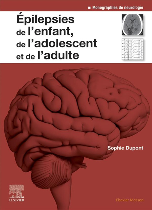 Emprunter Epilepsies de l'enfant, de l'adolescent et de l'adulte livre