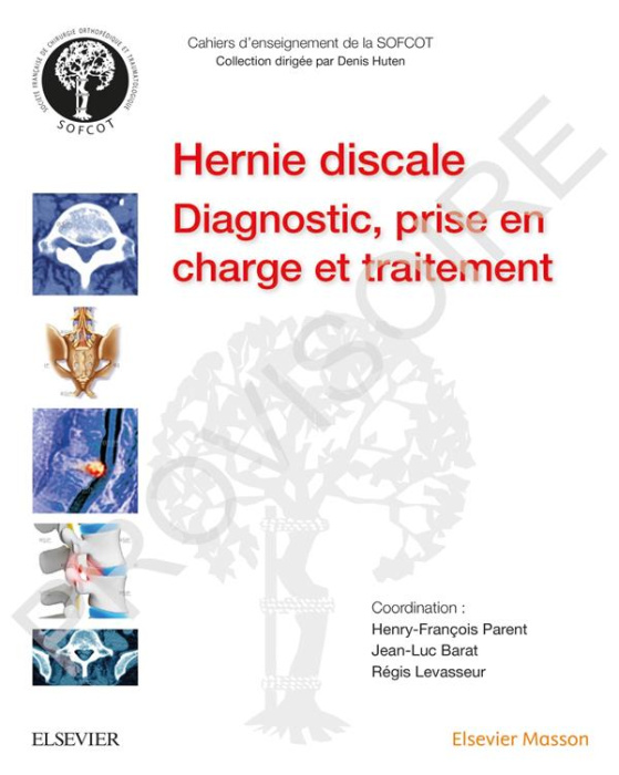 Emprunter La hernie discale lombaire livre