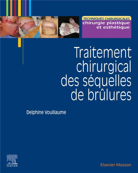 Emprunter Traitement chirurgical des séquelles des brûlures livre