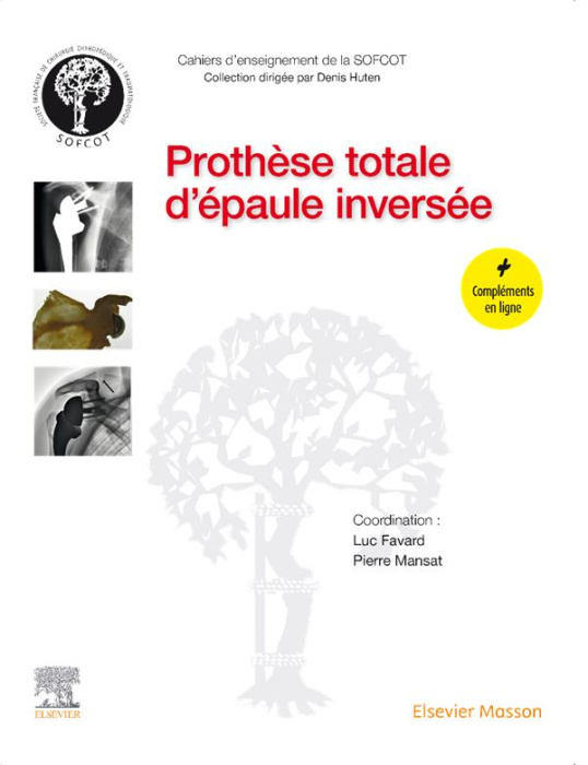 Emprunter Prothèse totale d'épaule inversée livre
