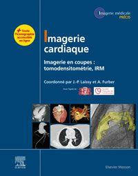 Emprunter Imagerie cardiaque. Imagerie en coupes : tomodensitométrie, IRM livre