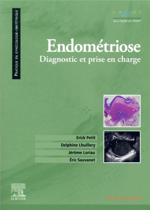 Emprunter Endométriose. Diagnostic et prise en charge livre