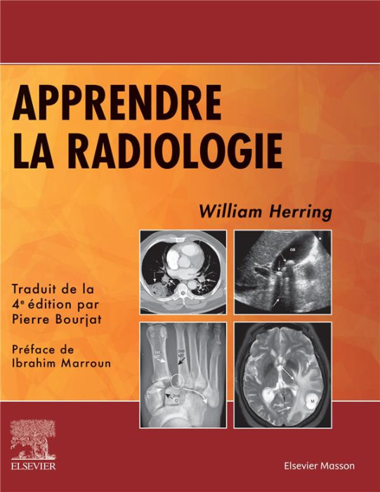 Emprunter Apprendre la radiologie. 4e édition livre