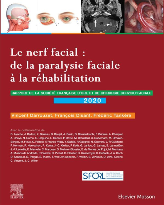 Emprunter Le nerf facial : de la paralysie faciale à la réhabilitation. Rapport 2020 de la Société française d livre