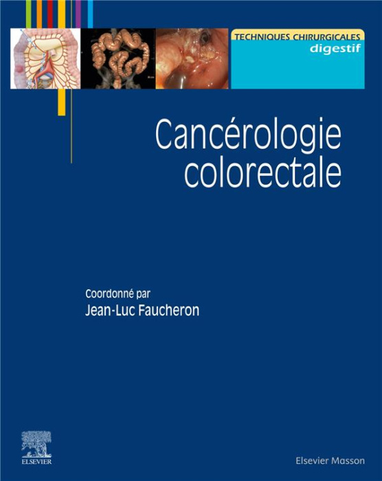 Emprunter Cancérologie colorectale livre