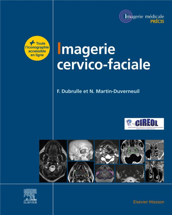 Emprunter Imagerie cervico-faciale. Massif facial - Sinus - Voies aérodigestives supérieures - Pathologies cer livre