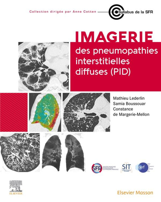 Emprunter Imagerie des pneumopathies interstitielles diffuses (PID) livre