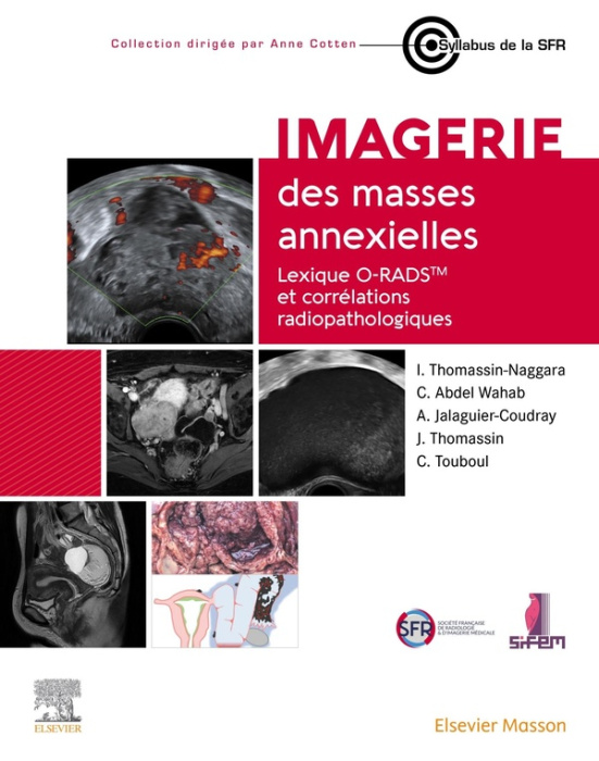 Emprunter Imagerie des masses annexielles. Lexique O-RADS et corrélations radiopathologiques livre