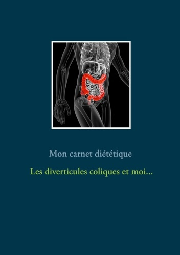 Emprunter Mon carnet diététique : les diverticules coliques et moi... livre