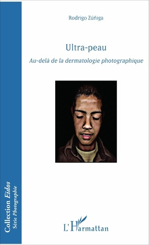 Emprunter ULTRA-PEAU - AU-DELA DE LA DERMATOLOGIE PHOTOGAPHIQUE livre