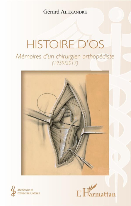 Emprunter Histoire d'os. Mémoires d'un chirurgien orthopédiste (1959-2017) livre