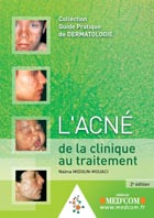 Emprunter L'acné de la clinique au traitement. 2e édition livre
