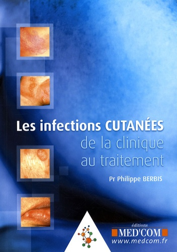 Emprunter Les infections cutanées livre