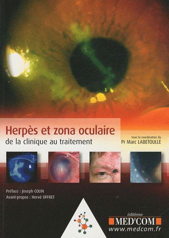 Emprunter Herpès et zona oculaire. De la clinique au traitement livre