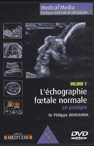 Emprunter L'Echographie foetale normale en pratique volume 1. DVD vidéo livre