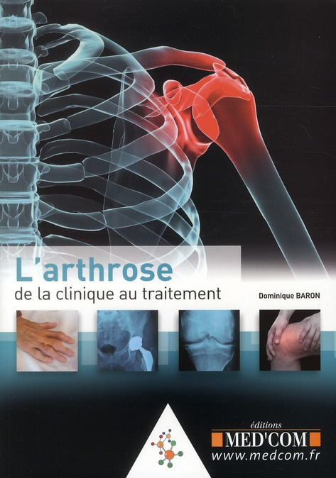 Emprunter L'arthrose livre