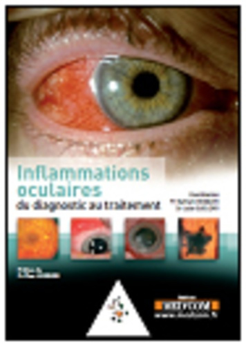 Emprunter L'inflammation oculaire livre