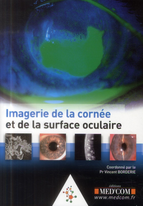 Emprunter Image de la cornée et de la surface oculaire livre