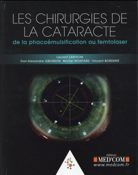 Emprunter Les chirurgies de la cataracte. De la phacoémulsification au femtolaser livre