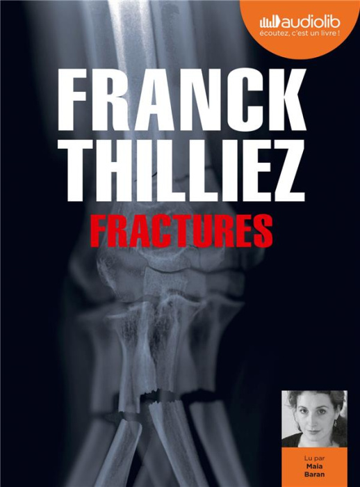 Emprunter Fractures. 1 CD audio MP3 livre