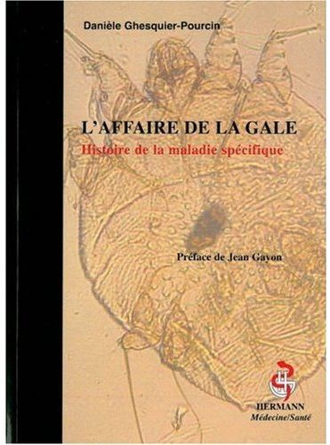 Emprunter L'affaire de la gale. Histoire de la maladie spécifique livre