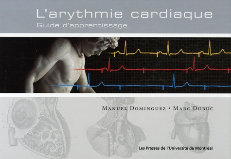 Emprunter Arythmie cardiaque. Guide d'apprentissage livre
