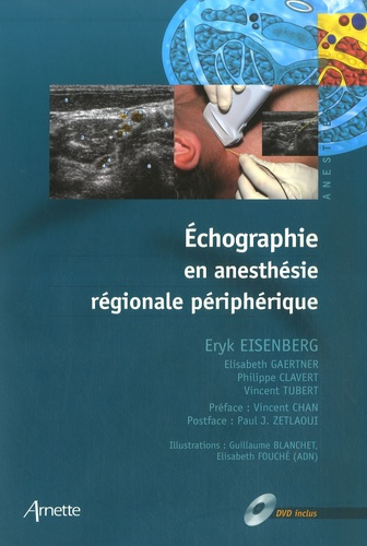 Emprunter ECHOGRAPHIE EN ANESTHESIE REGIONALE DVD INCLUS livre