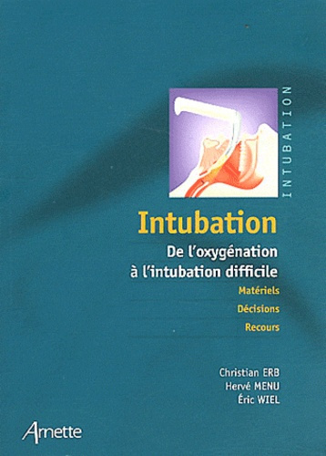 Emprunter Intubation. De l'oxygénation à l'intubation difficile livre