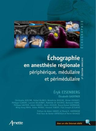 Emprunter Echographie en anesthésie régionale périphérique, médullaire et périmédullaire. 2e édition livre