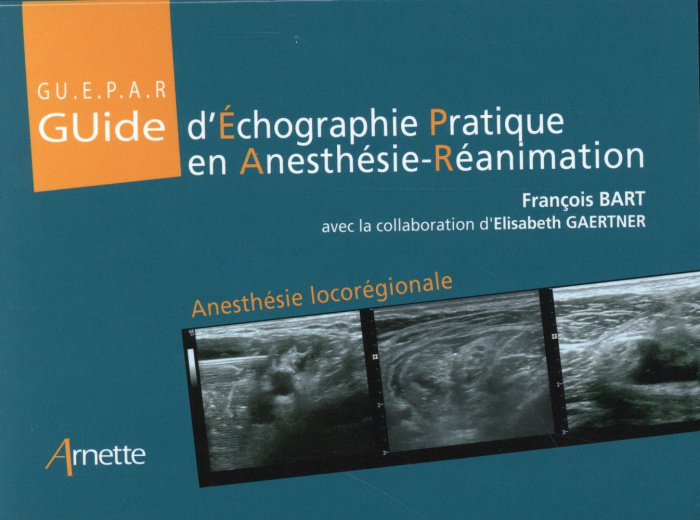 Emprunter Guide d'Echographie Pratique en Anesthésie-Réanimation. Anesthésie Iocorégionale livre