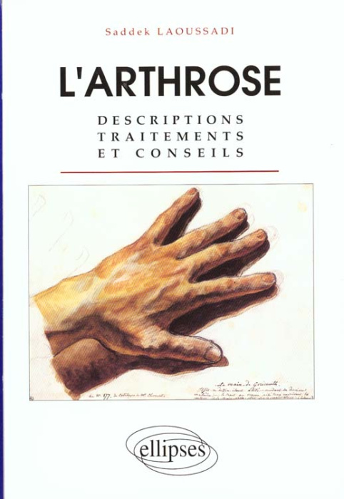 Emprunter L'ARTHROSE. Descriptions, traitements et conseils livre