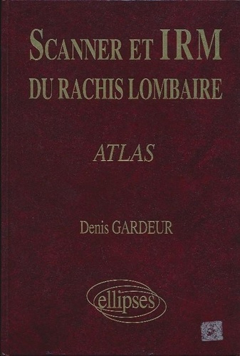 Emprunter Scanner et IRM du rachis lombaire livre